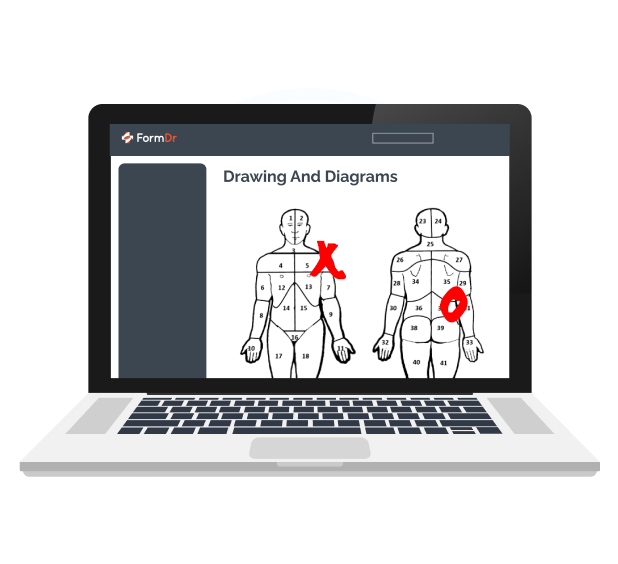 Body diagram in an intake form for patients to mark areas of pain